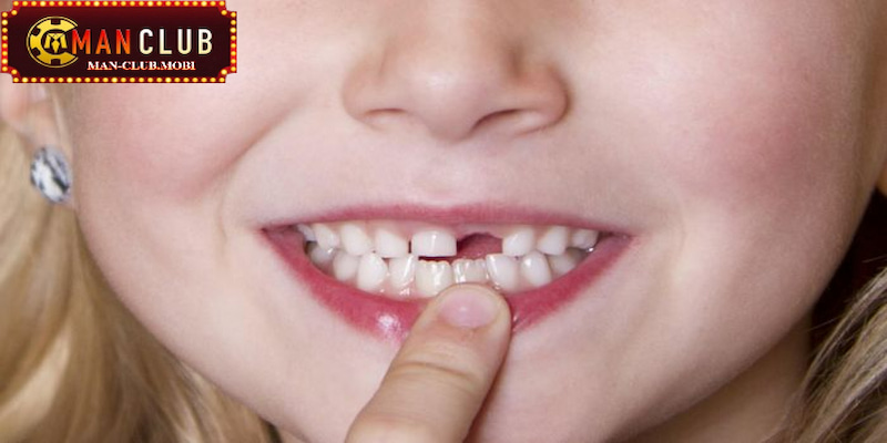 Mơ thấy rụng răng cửa liên quan đến tiền bạc, tài sản Mơ thấy rụng răng cửa liên quan đến tiền bạc, tài sản