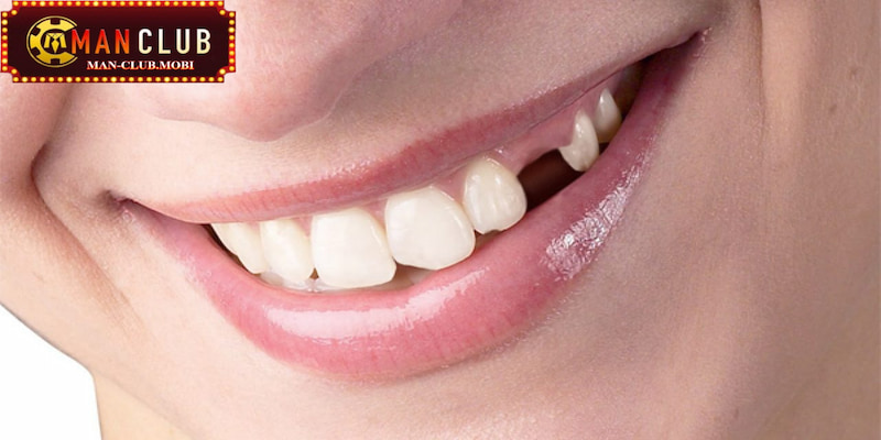 Giải mã ý nghĩa giấc mơ rụng răng và những việc nên làm khi gặp điều này Giải mã ý nghĩa giấc mơ rụng răng và những việc nên làm khi gặp điều này
