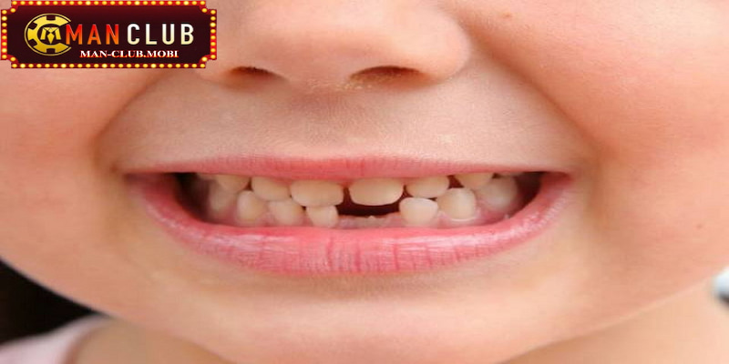 Mơ thấy rụng răng không chảy máu cần phải cẩn trọng đến sức khỏe Mơ thấy rụng răng không chảy máu cần phải cẩn trọng đến sức khỏe